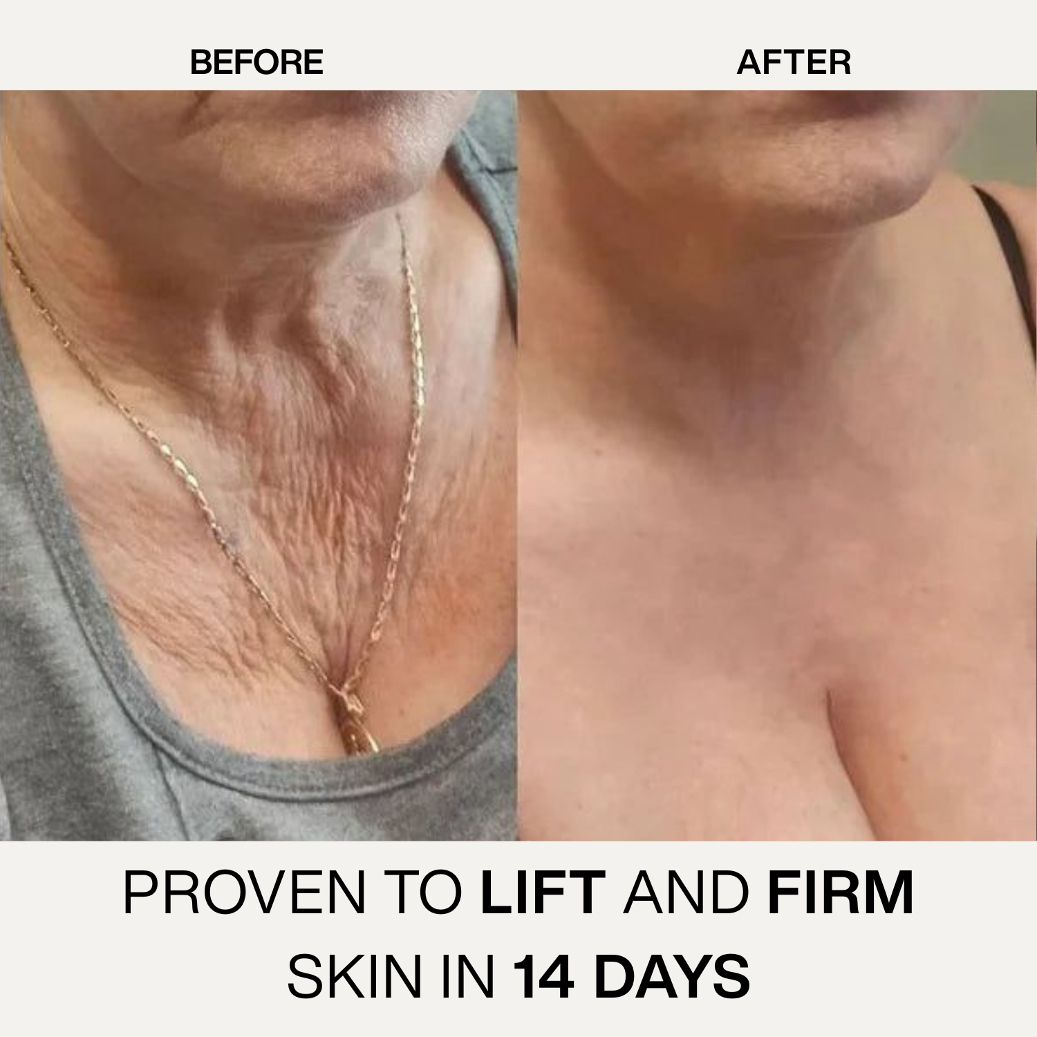 Venom™ Revive Body Oil